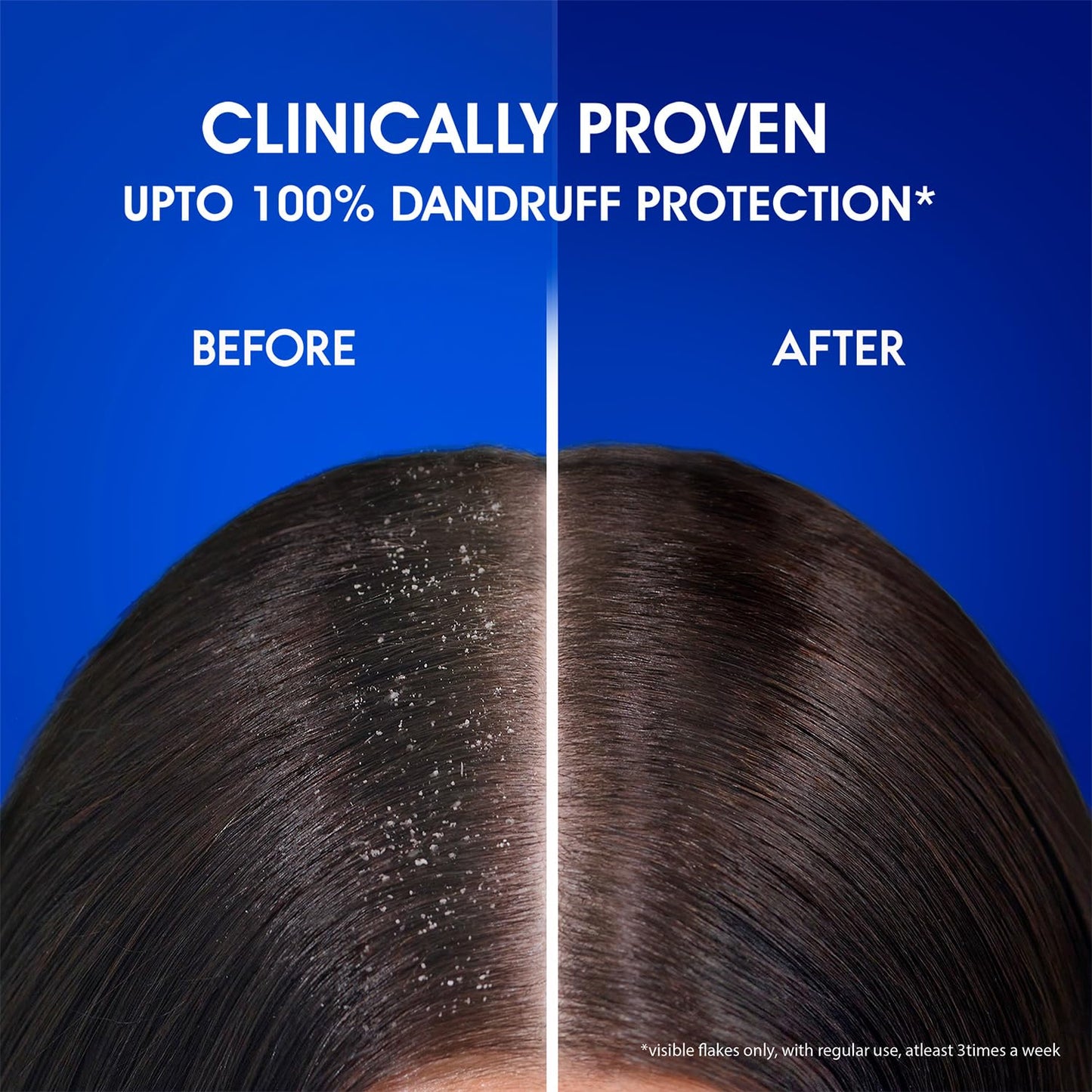 Head & Shoulders , Anti Dandruff Shampoo, Smooth & Silky, 180 ML, White