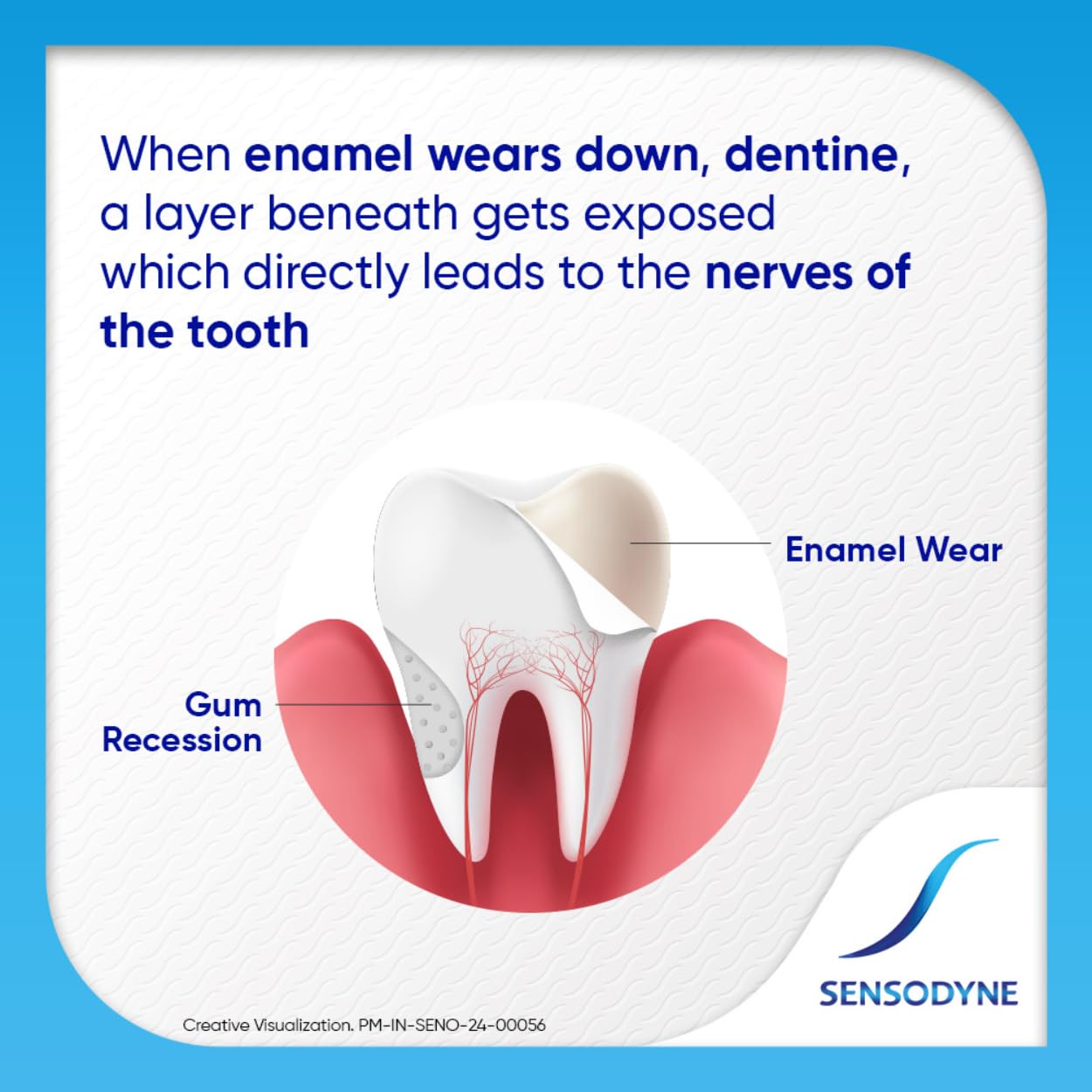 Sensodyne Toothpaste: Fresh Gel Sensitivity Relief Toothpaste for everyday cool freshness,Dentist Recommended Brand, 75gm Pack of 2